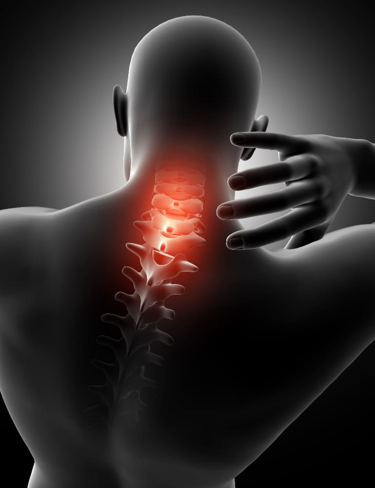 <strong>Cirugía cervical accesible en CDMX</strong>: tu salud al mejor precio