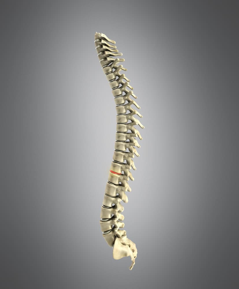 <strong>Cirugía de columna costo razonable en CDMX</strong>