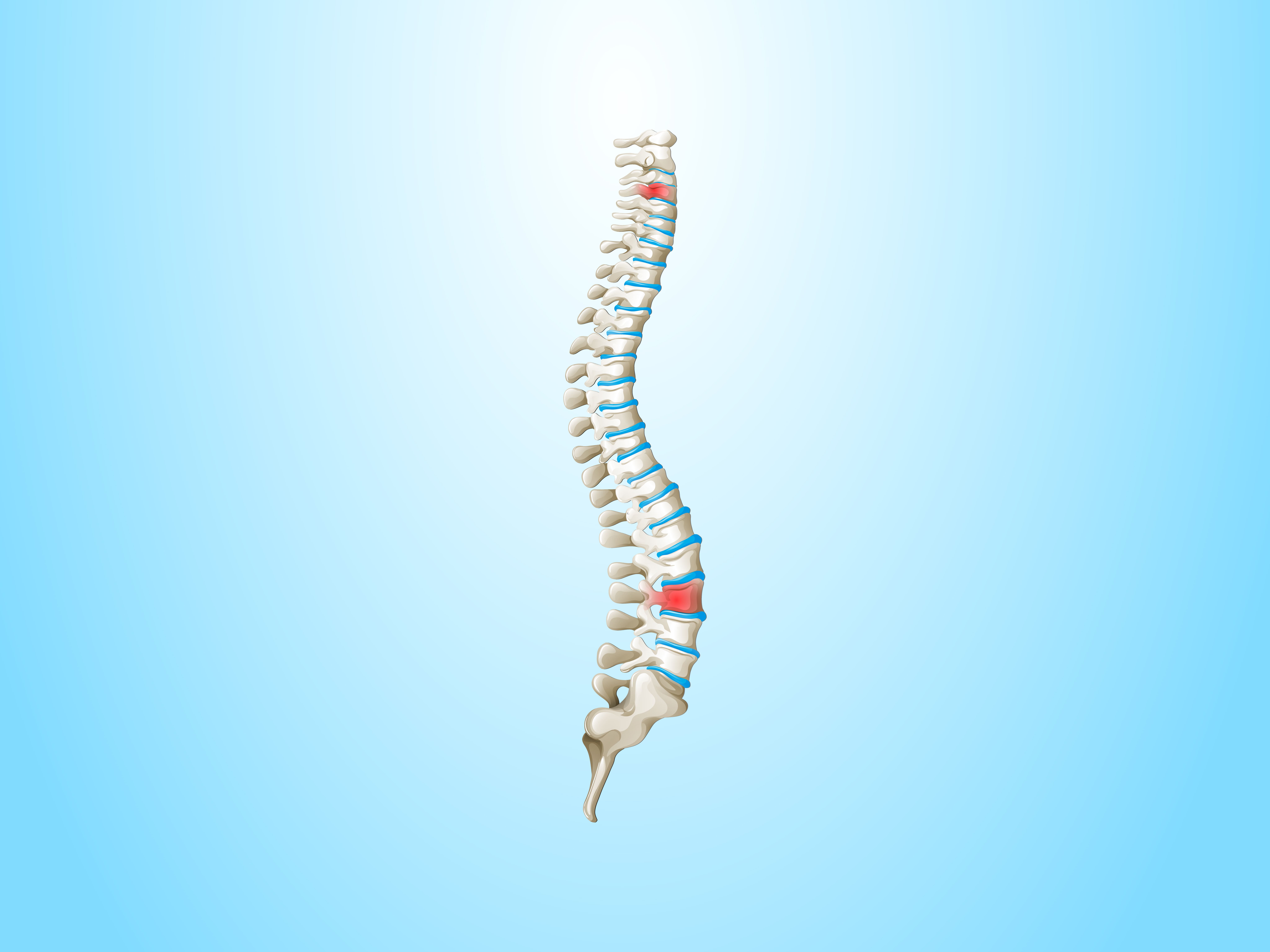 Descubre el <strong>costo de cirugía para escoliosis en CDMX</strong>
