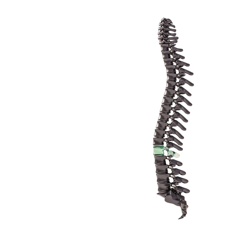 <strong>Especialistas en columna vertebral en CDMX</strong>: excelencia médica