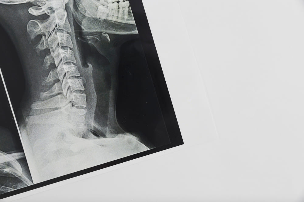 Conoce más sobre <strong>neurocirugía avanzada en CDMX</strong>